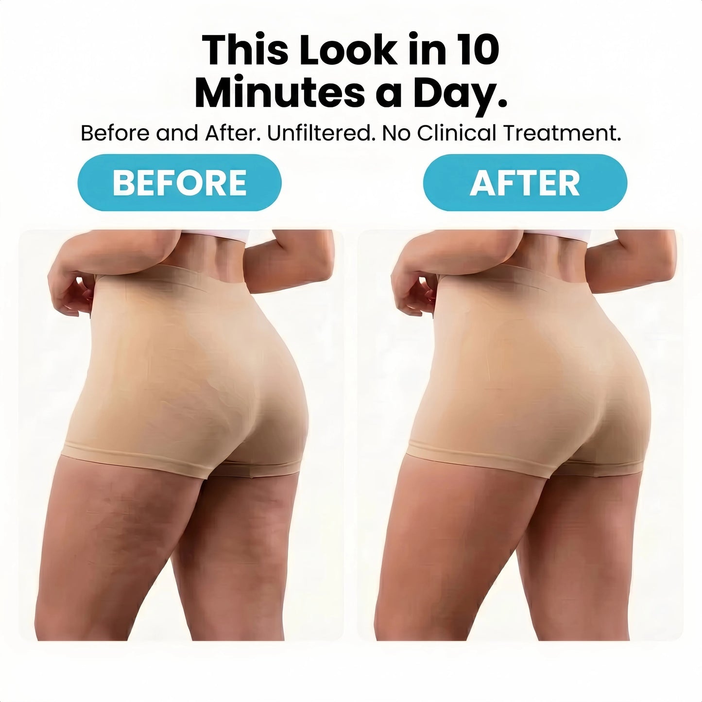 RelaxZone™ SculptRoll™ | At-Home Cellulite Massage – For a Smooth & Firm Appearance